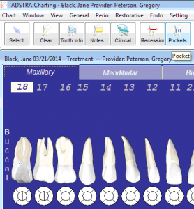 ADSTRA Software Chart Pocket Measurements Screen