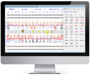 ADSTRA Dental Charting Software on Mac Computer Screen