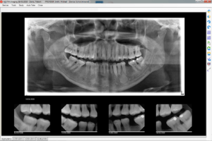 ADSTRA Imaging - Dental Image Management: x-rays