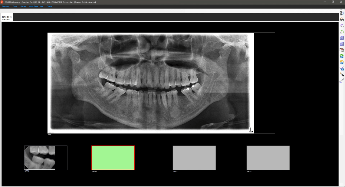 Dental Practice Imaging Software - Auto-take dental images