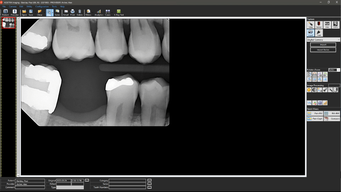 Dental Practice Imaging Software - Patient Education Infographics